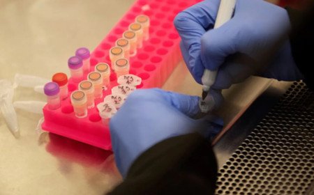Saliva Based Testing Kit for COVID-19 Developed By Researcher At Jamia Millia Islamic University