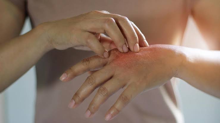Comprehensive Guide to Skin Diseases: Causes, Symptoms, Diagnosis, and Advanced Treatments