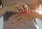 Comprehensive Guide to Skin Diseases: Causes, Symptoms, Diagnosis, and Advanced Treatments