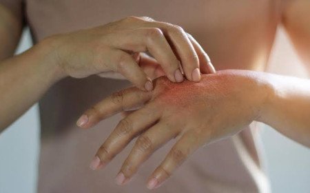 Comprehensive Guide to Skin Diseases: Causes, Symptoms, Diagnosis, and Advanced Treatments