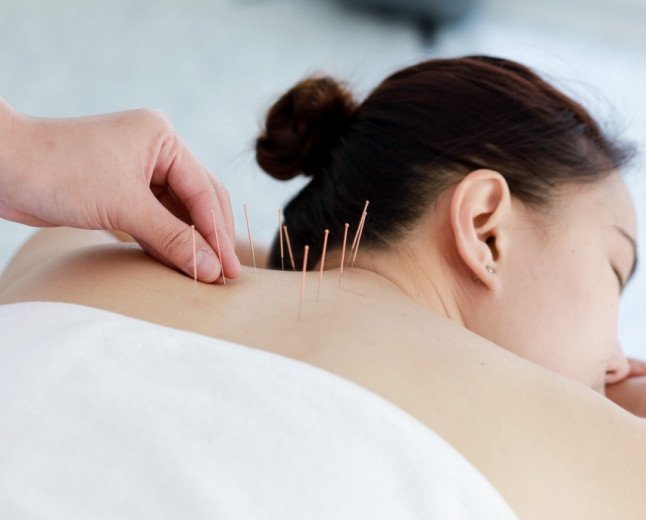 Acupuncture: A Thing for the Healthy Person?