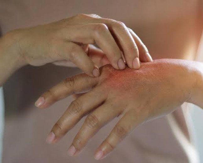 Comprehensive Guide to Skin Diseases: Causes, Symptoms, Diagnosis, and Advanced Treatments