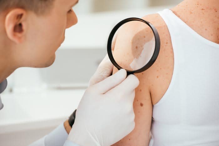 Skin Diseases